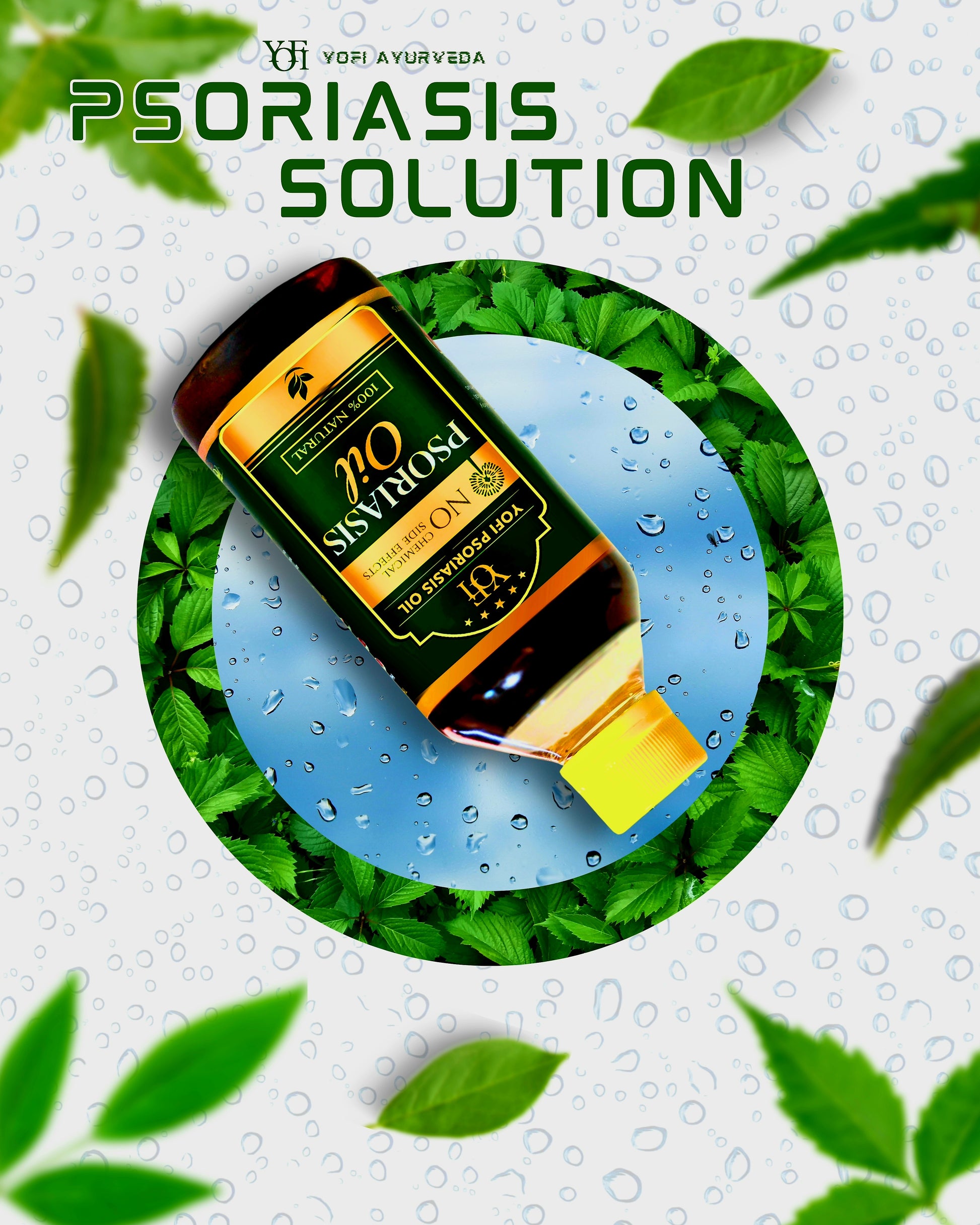 Psoriasis solution bottle with green leaves and water droplets on a light gray background
